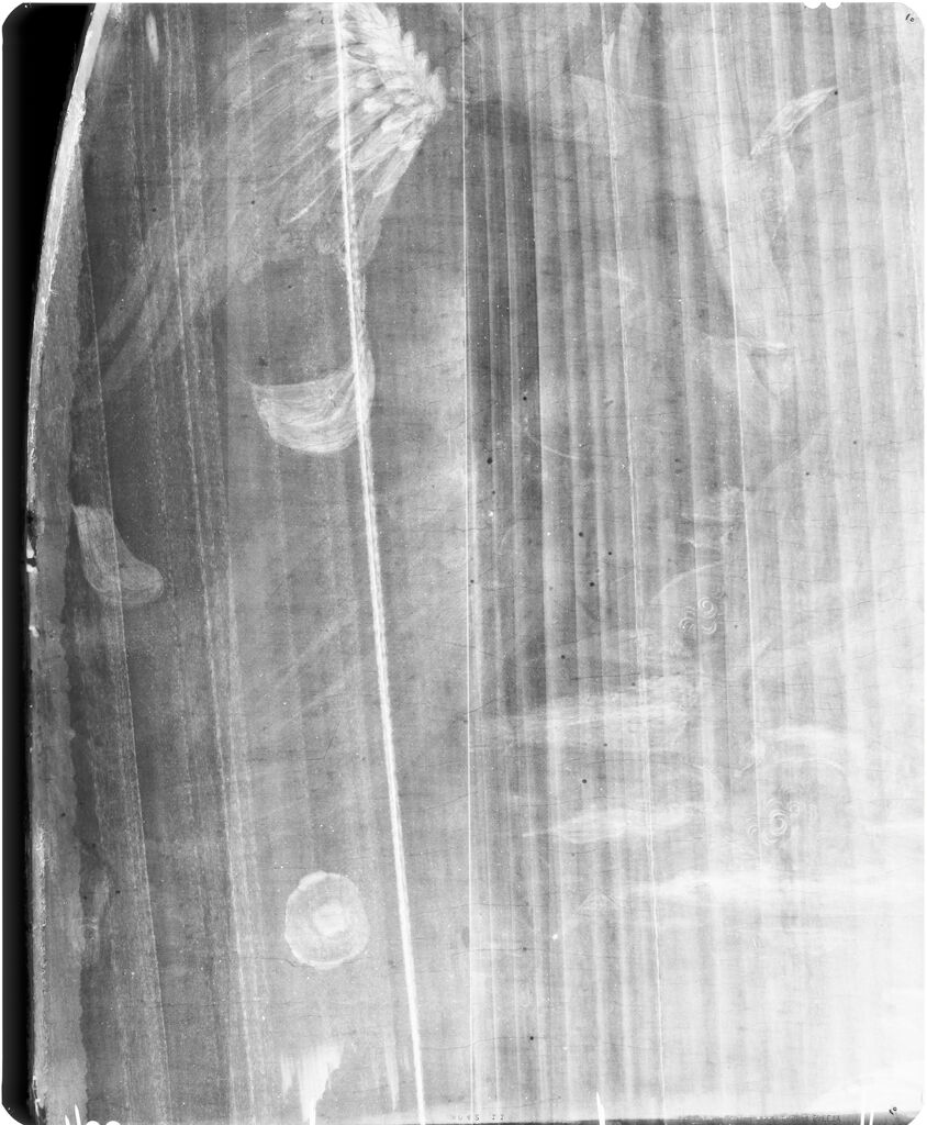 X-Radiograph(S) Of 