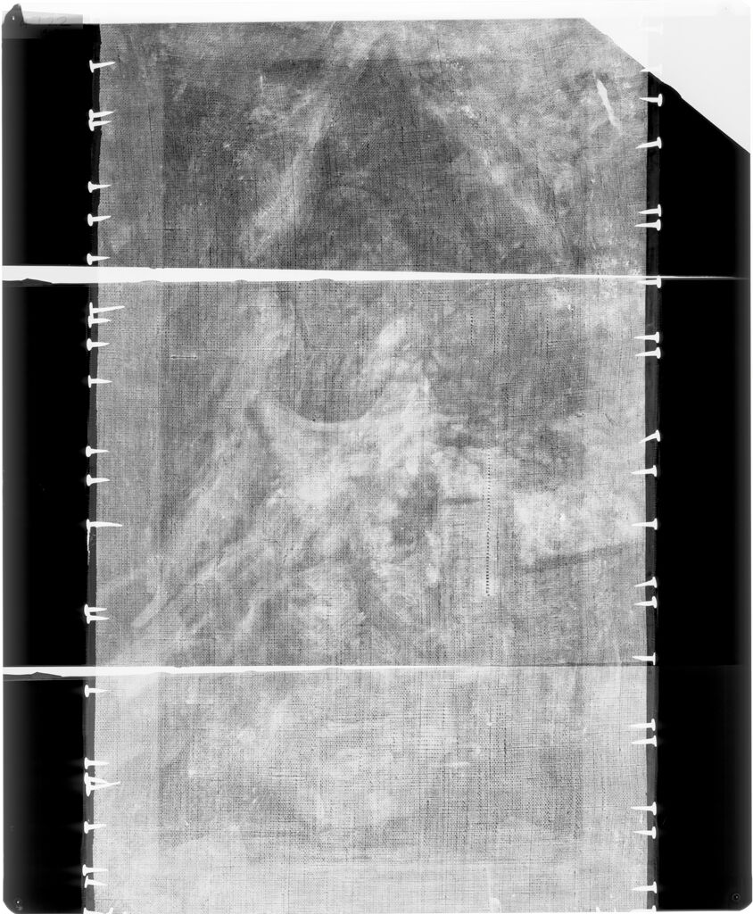 X-Radiograph(S) Of 